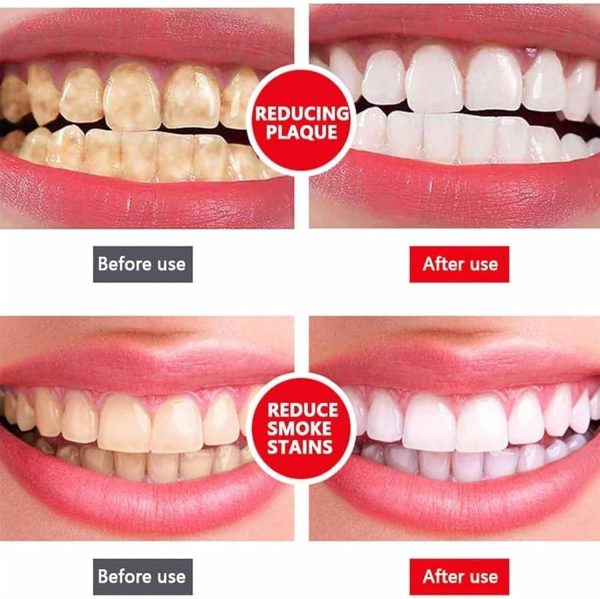 SP-4 ultra Teeth Whitening Toothpaste + Free Nano Toothbrush For Sensitive Gum