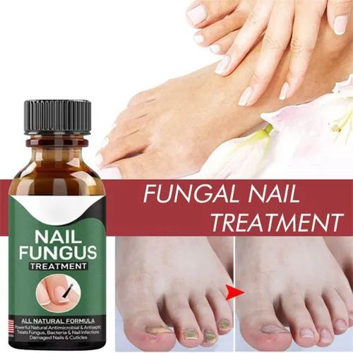 Anti-Fungal Nail Repair Serum – Fast Nail Fungus Treatment & Nail Restoration Gel