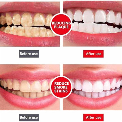 SP-4 ultra Teeth Whitening Toothpaste + Free Nano Toothbrush For Sensitive Gum