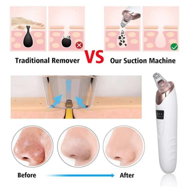 4-in-1 Rechargeable Blackhead Remover: Vacuum, Pore Cleaner, Extractor