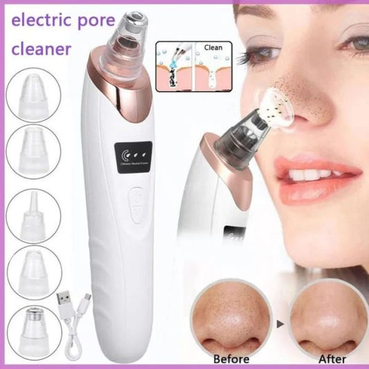 4-in-1 Rechargeable Blackhead Remover: Vacuum, Pore Cleaner, Extractor